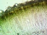 Aspicilia contorta image