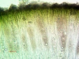 Aspicilia contorta image