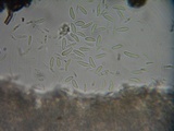 Mollisia melaleuca image