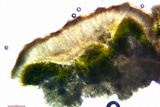 Acarospora rosulata image