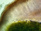 Acarospora rosulata image