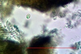 Lecidella carpathica image