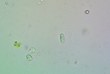 Candelariella rosulans image