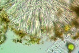 Candelariella rosulans image