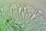 Candelariella rosulans image
