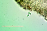 Lecanora carpinea image