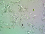 Lecanora carpinea image