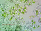 Lecanora carpinea image