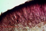 Tephromela atra var. atra image