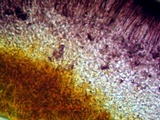 Tephromela atra var. atra image