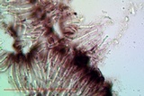 Tephromela atra var. atra image