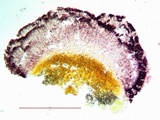 Tephromela atra var. atra image
