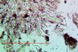 Tephromela atra var. atra image