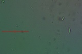 Lecanora confusa image