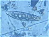 Navicella pileata image