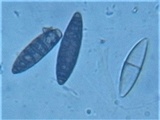 Navicella pileata image