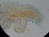 Peziza echinulata image