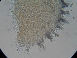 Peziza echinulata image