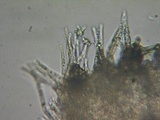 Peziza echinulata image