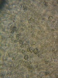 Peziza echinulata image