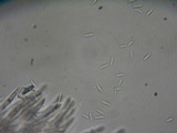 Peziza echinulata image