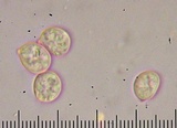 Hydnum aerostatisporum image