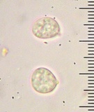 Hydnum aerostatisporum image