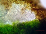 Caloplaca bolacina image