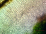 Caloplaca bolacina image