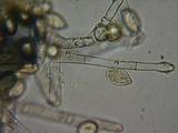 Botryobasidium conspersum image