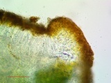 Caloplaca subsoluta image