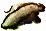 Caloplaca bolacina image