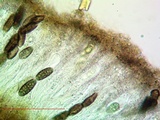 Buellia oidalea image