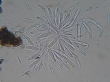 Mycosphaerella pteridis image