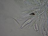 Mycosphaerella pteridis image