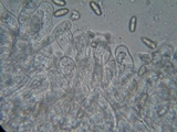 Inocybe rimosa image