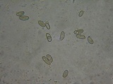Inocybe rimosa image