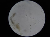 Sarcoscypha austriaca image