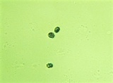Leptonia cyanea image