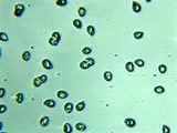 Inocybe hirsuta var. maxima image