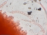 Pyronema omphalodes image