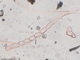 Pyronema omphalodes image