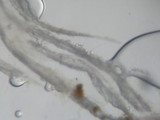 Tilachlidium brachiatum image