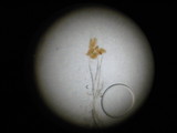Tilachlidium brachiatum image