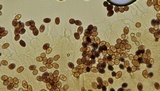 Leucocoprinus cepistipes image