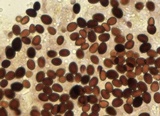Leucocoprinus cepistipes image