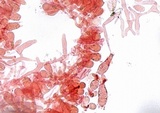 Leucocoprinus cepistipes image