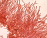 Leucocoprinus cepistipes image
