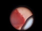 Marasmius nigrodiscus image