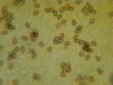 Melanoleuca lewisii image